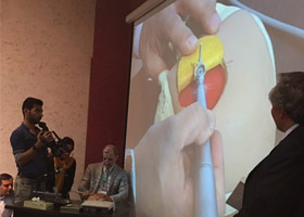 و کارگاه نسل جدید سمعک های قابل کاشت APON کنگره بین المللی BAHA